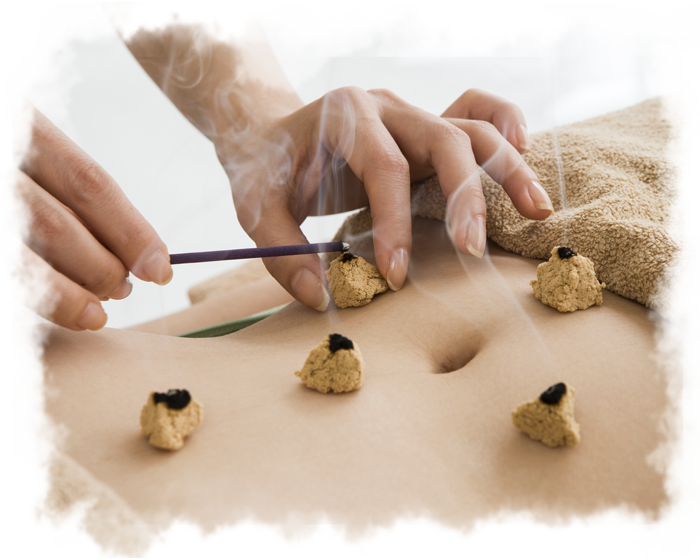 moxibustion.png